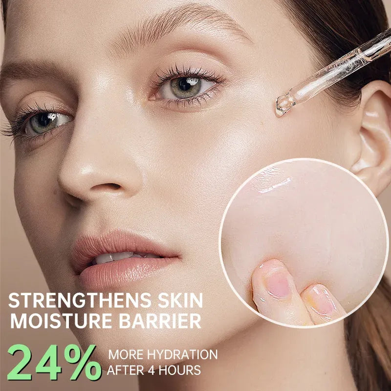 UPTOWN LA Anti Acne Serum with Salicylic Acid 30ml | Acne Treatment, Oil Control & Pore Minimizing Face Serum