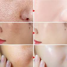 UPTOWN LA Niacinamide 10% + Zinc 1% Radiance Boost Serum Formula for Clear and Glowing Skin