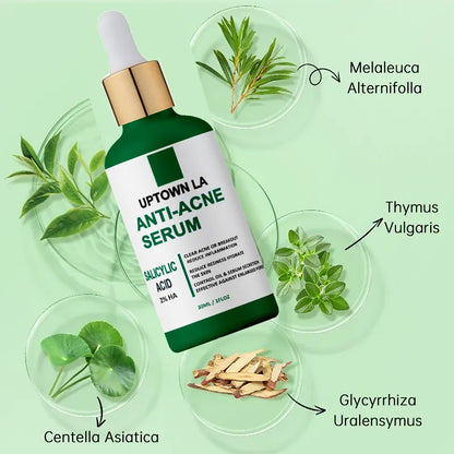 UPTOWN LA Anti Acne Serum with Salicylic Acid 30ml | Acne Treatment, Oil Control & Pore Minimizing Face Serum