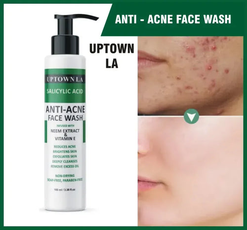 UPTOWN LA Anti Acne Face Wash – Oil Control Cleanser for Acne, Blackheads & Whiteheads | Deep Pore Cleansing Face Wash